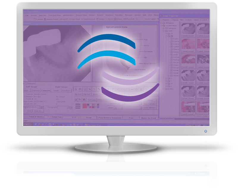 TDO screen